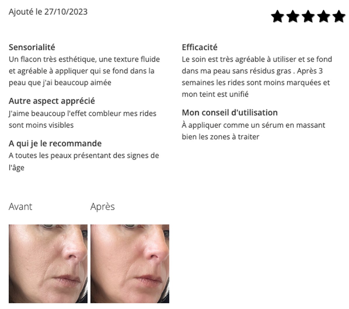 Avis cinq étoiles d’une ambassadrice ENO, octobre 2023, avec photos de sa peau avant et après