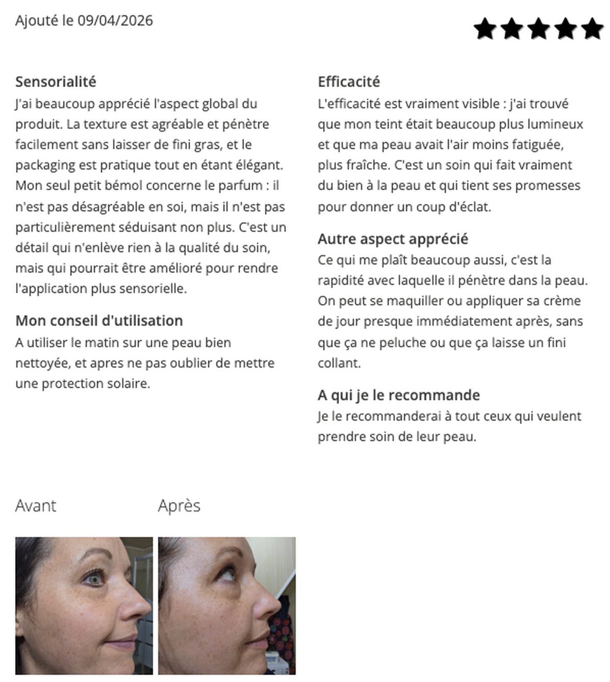 Avis détaillé ENO avec photos avant et après